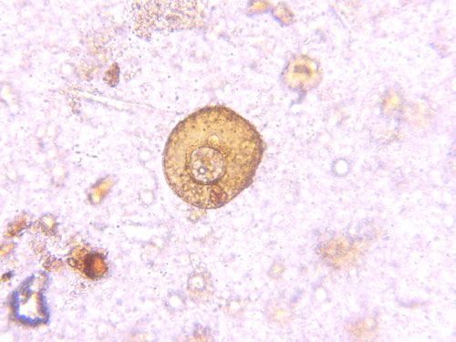 arcella amoeba under microscope